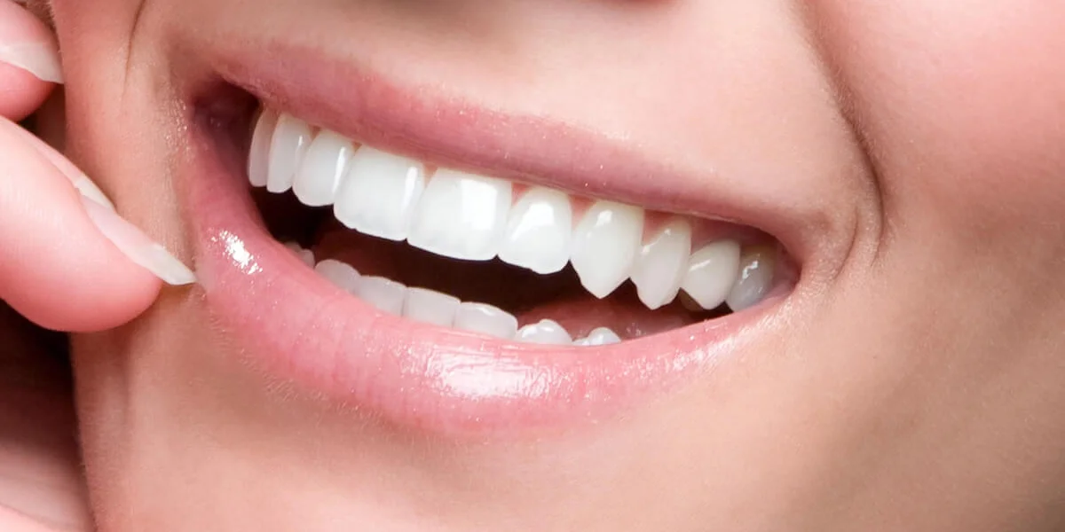 Sourire parfait après traitement esthétique dentaire